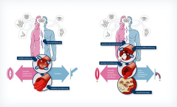 Diabetes und Sexualität Illustration